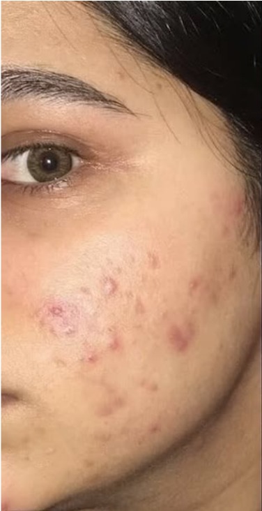 Dark spots before